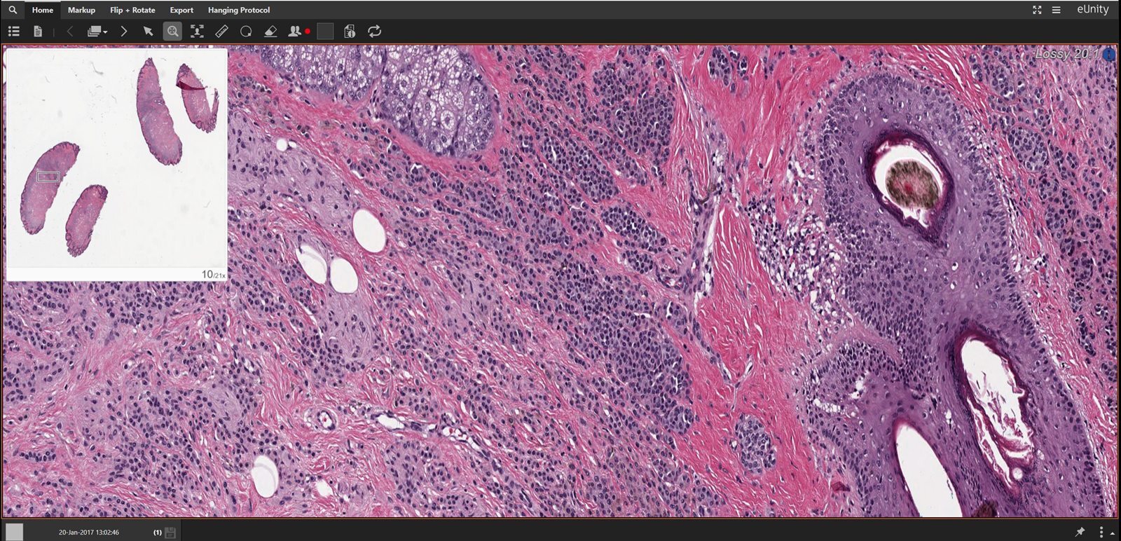 eUnity showing a whole-slide pathology image with a navigator inset.