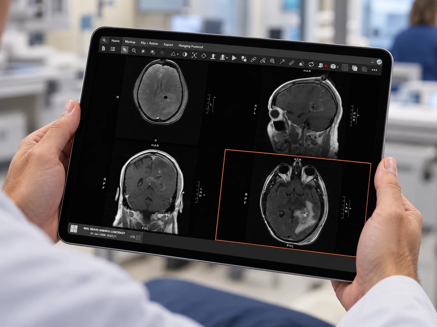 eUnity running in a browser on a tablet held by a clinician, showing a four-pane brain MRI study.