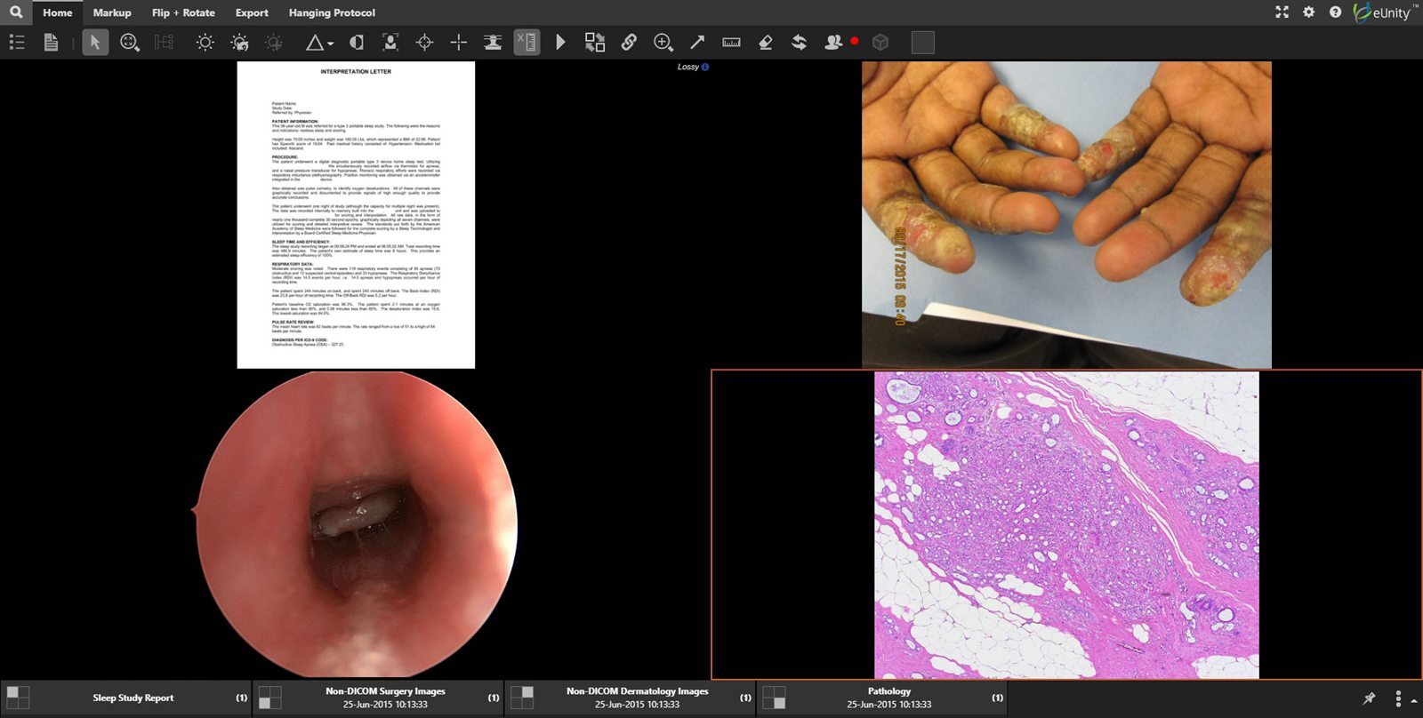 eUnity displaying non-DICOM clinical content alongside imaging.