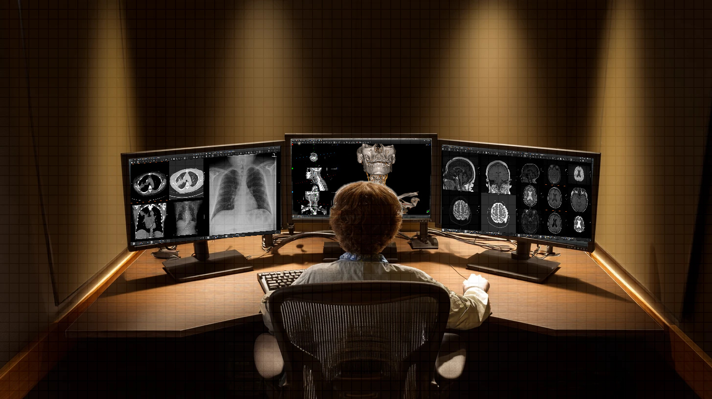 A radiologist at a three-monitor reading station running eUnity, with a chest CT and radiograph on the left screen, a 3D cervical angiography render on the centre screen, and a brain MR study on the right.