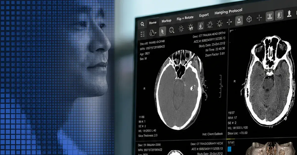 Mach7 brochure: the Mach7 eUnity Enterprise Diagnostic Viewer
