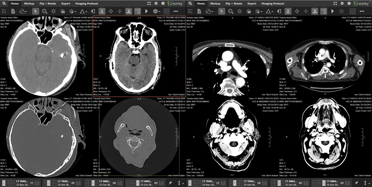 A CT series, one of thousands of images held in the archive.
