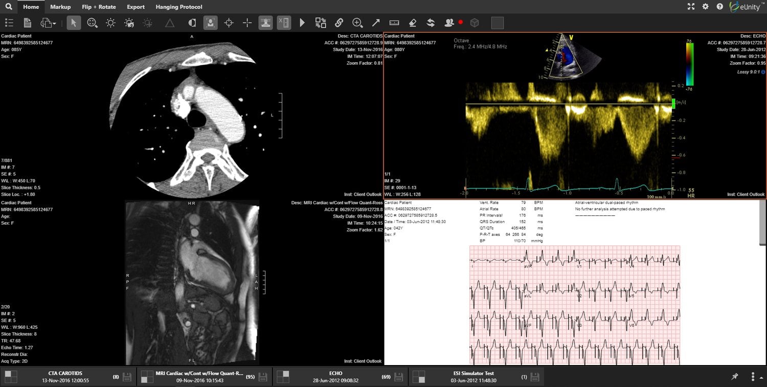 One eUnity workspace holding CT, MR, echo and ECG for the same patient.