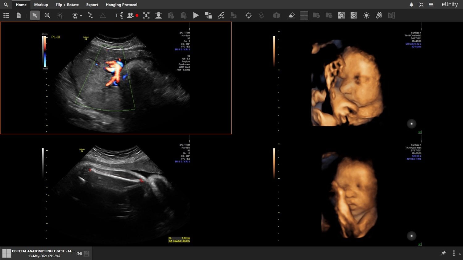 Obstetric ultrasound, arriving from the department that acquired it.