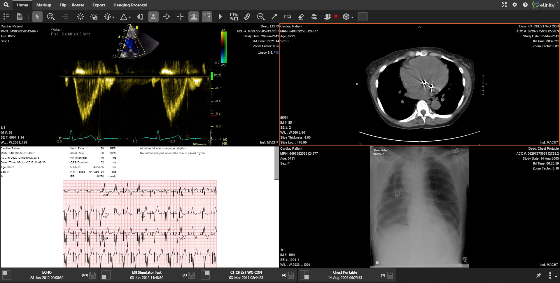 eUnity-clinical-DICOM