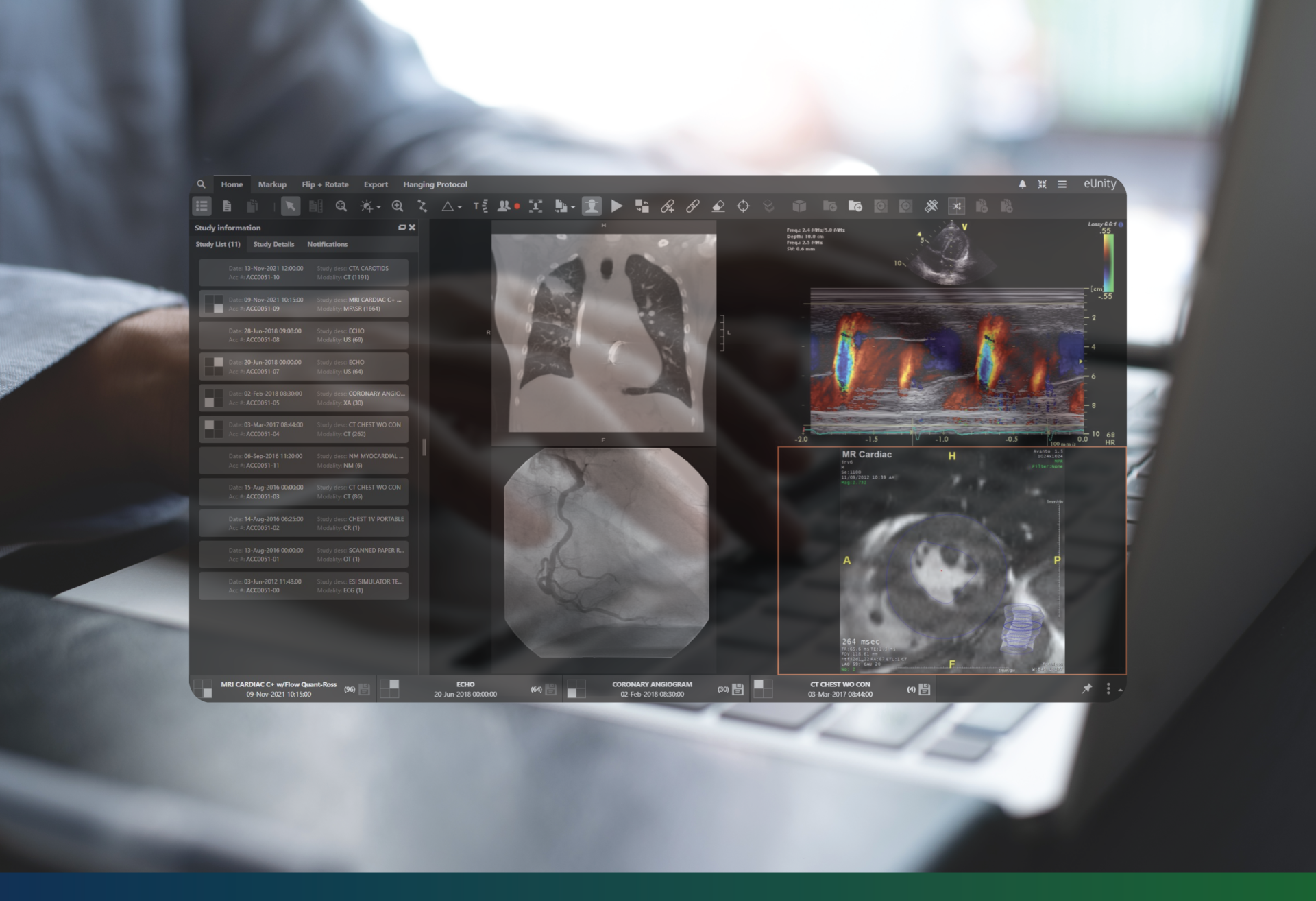 A screenshot from Mach7's eUnity viewer being displayed in an artistic fashoin over an image of a man working on a laptop.