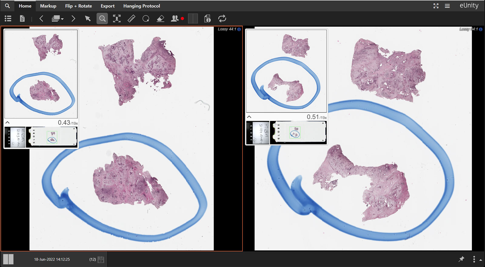 digital pathology screens