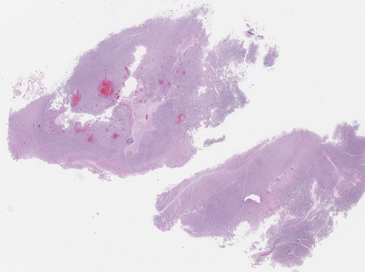 pathologist workflow