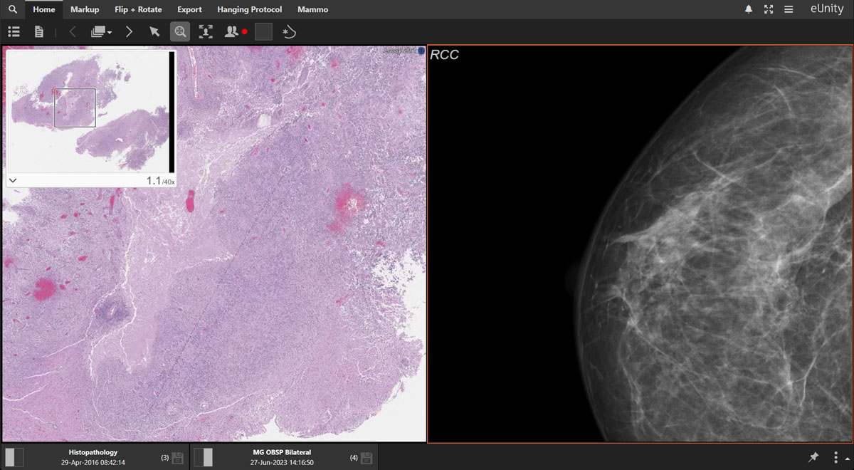 pathology and radiology